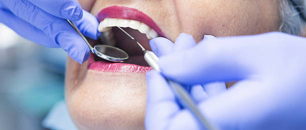 Best Emergency Tooth Extraction in Prudhoe Bay, AK